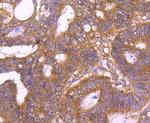 TSG101 Antibody in Immunohistochemistry (Paraffin) (IHC (P))