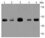 TSG101 Antibody in Western Blot (WB)