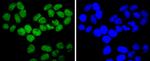 ARID1A Antibody in Immunocytochemistry (ICC/IF)