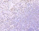 ARID1A Antibody in Immunohistochemistry (Paraffin) (IHC (P))