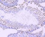 ARID1A Antibody in Immunohistochemistry (Paraffin) (IHC (P))