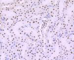 ARID1A Antibody in Immunohistochemistry (Paraffin) (IHC (P))