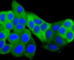 HSP27 Antibody in Immunocytochemistry (ICC/IF)