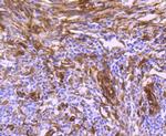 HSP27 Antibody in Immunohistochemistry (Paraffin) (IHC (P))