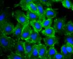 Actin Antibody in Immunocytochemistry (ICC/IF)