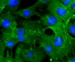 Actin Antibody in Immunocytochemistry (ICC/IF)