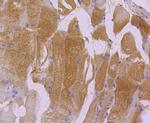 Actin Antibody in Immunohistochemistry (Paraffin) (IHC (P))