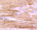 Actin Antibody in Immunohistochemistry (Paraffin) (IHC (P))