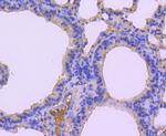 MKP-1 Antibody in Immunohistochemistry (Paraffin) (IHC (P))