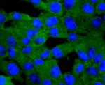 PKC delta Antibody in Immunocytochemistry (ICC/IF)