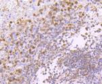 PKC delta Antibody in Immunohistochemistry (Paraffin) (IHC (P))