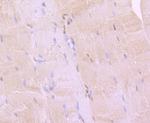 BMI-1 Antibody in Immunohistochemistry (Paraffin) (IHC (P))