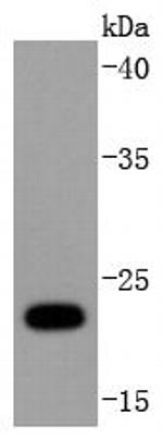 UBD Antibody in Western Blot (WB)