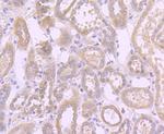 Fas Antibody in Immunohistochemistry (Paraffin) (IHC (P))