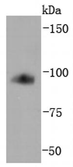 CD71 (Transferrin Receptor) Antibody in Western Blot (WB)