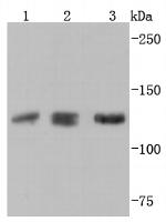 Abl2 Antibody in Western Blot (WB)