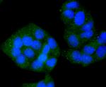 VAMP8 Antibody in Immunocytochemistry (ICC/IF)