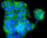 VAMP8 Antibody in Immunocytochemistry (ICC/IF)