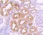 VAMP8 Antibody in Immunohistochemistry (Paraffin) (IHC (P))