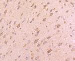 VAMP8 Antibody in Immunohistochemistry (Paraffin) (IHC (P))