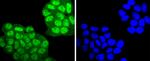 Phospho-PKC alpha (Thr638) Antibody in Immunocytochemistry (ICC/IF)