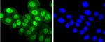 Phospho-PKC alpha (Thr638) Antibody in Immunocytochemistry (ICC/IF)