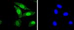 Phospho-PKC alpha (Thr638) Antibody in Immunocytochemistry (ICC/IF)