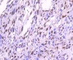 Phospho-PKC alpha (Thr638) Antibody in Immunohistochemistry (Paraffin) (IHC (P))