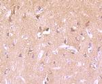 Phospho-PKC alpha (Thr638) Antibody in Immunohistochemistry (Paraffin) (IHC (P))