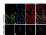 Fibronectin Antibody in Immunocytochemistry (ICC/IF)