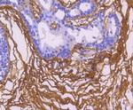 Fibronectin Antibody in Immunohistochemistry (Paraffin) (IHC (P))