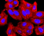 PDIA6 Antibody in Immunocytochemistry (ICC/IF)