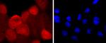 S100A6 Antibody in Immunocytochemistry (ICC/IF)