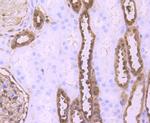 S100A6 Antibody in Immunohistochemistry (Paraffin) (IHC (P))