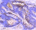 S100A6 Antibody in Immunohistochemistry (Paraffin) (IHC (P))