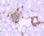 S100A6 Antibody in Immunohistochemistry (Paraffin) (IHC (P))