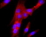 gamma Tubulin Antibody in Immunocytochemistry (ICC/IF)