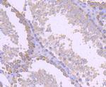 gamma Tubulin Antibody in Immunohistochemistry (Paraffin) (IHC (P))