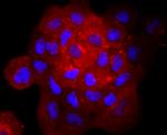 gamma Catenin Antibody in Immunocytochemistry (ICC/IF)