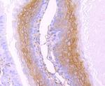 gamma Catenin Antibody in Immunohistochemistry (Paraffin) (IHC (P))