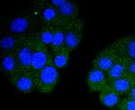 Cardiac Troponin I Antibody in Immunocytochemistry (ICC/IF)