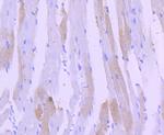 Cardiac Troponin I Antibody in Immunohistochemistry (Paraffin) (IHC (P))