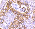 S100A10 Antibody in Immunohistochemistry (Paraffin) (IHC (P))