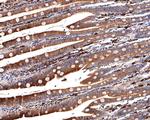 HMGCR Antibody in Immunohistochemistry (Paraffin) (IHC (P))