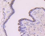 FOXP1 Antibody in Immunohistochemistry (Paraffin) (IHC (P))