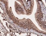 Galectin 3 Antibody in Immunohistochemistry (Paraffin) (IHC (P))