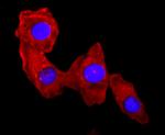 S100A9 Antibody in Immunocytochemistry (ICC/IF)