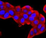 S100A9 Antibody in Immunocytochemistry (ICC/IF)