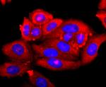 S100A9 Antibody in Immunocytochemistry (ICC/IF)