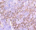 S100A9 Antibody in Immunohistochemistry (Paraffin) (IHC (P))